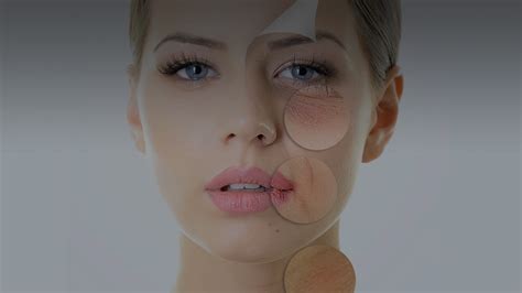 skin peel ballito|Dermatologist Umhlanga & Ballito, Durban, KZN .